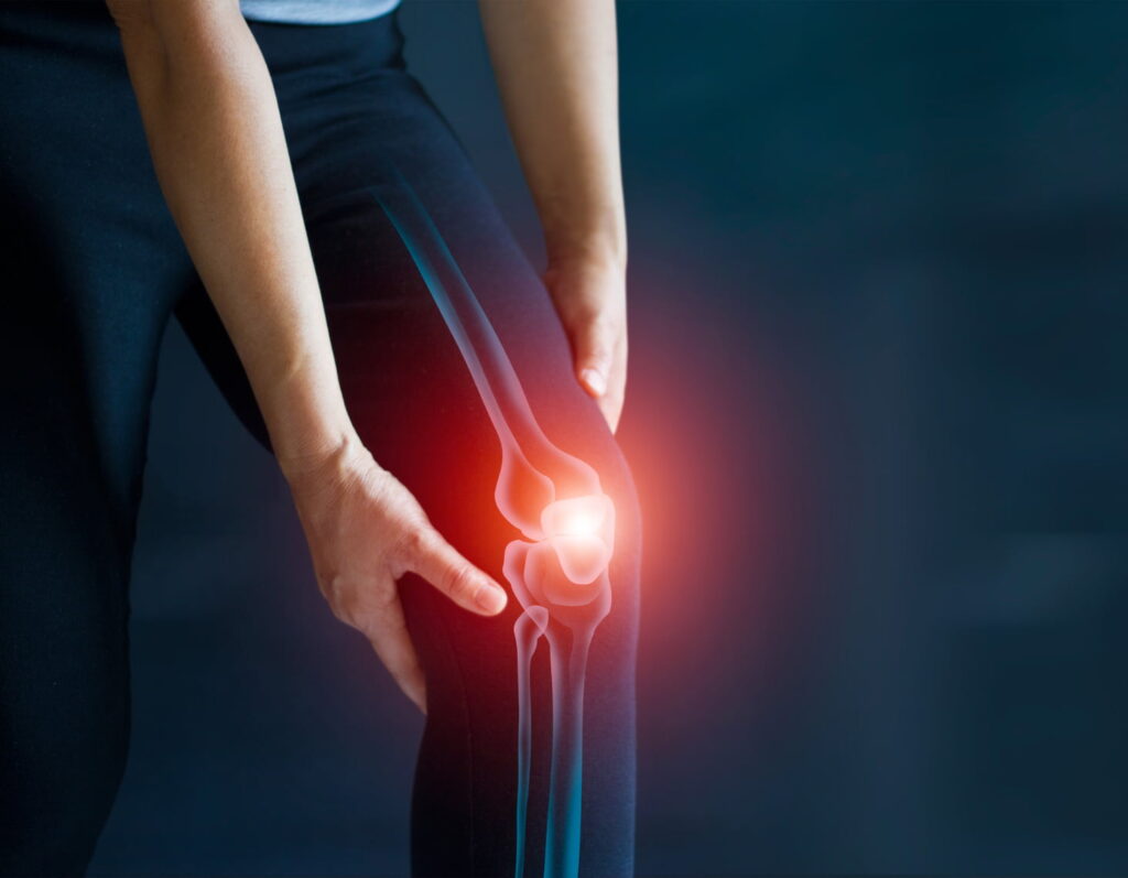 A woman is holding her knee with pain.