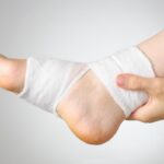 Sprained Ankle vs Broken Ankle What You Must Know