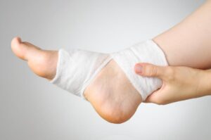 Sprained Ankle vs Broken Ankle What You Must Know
