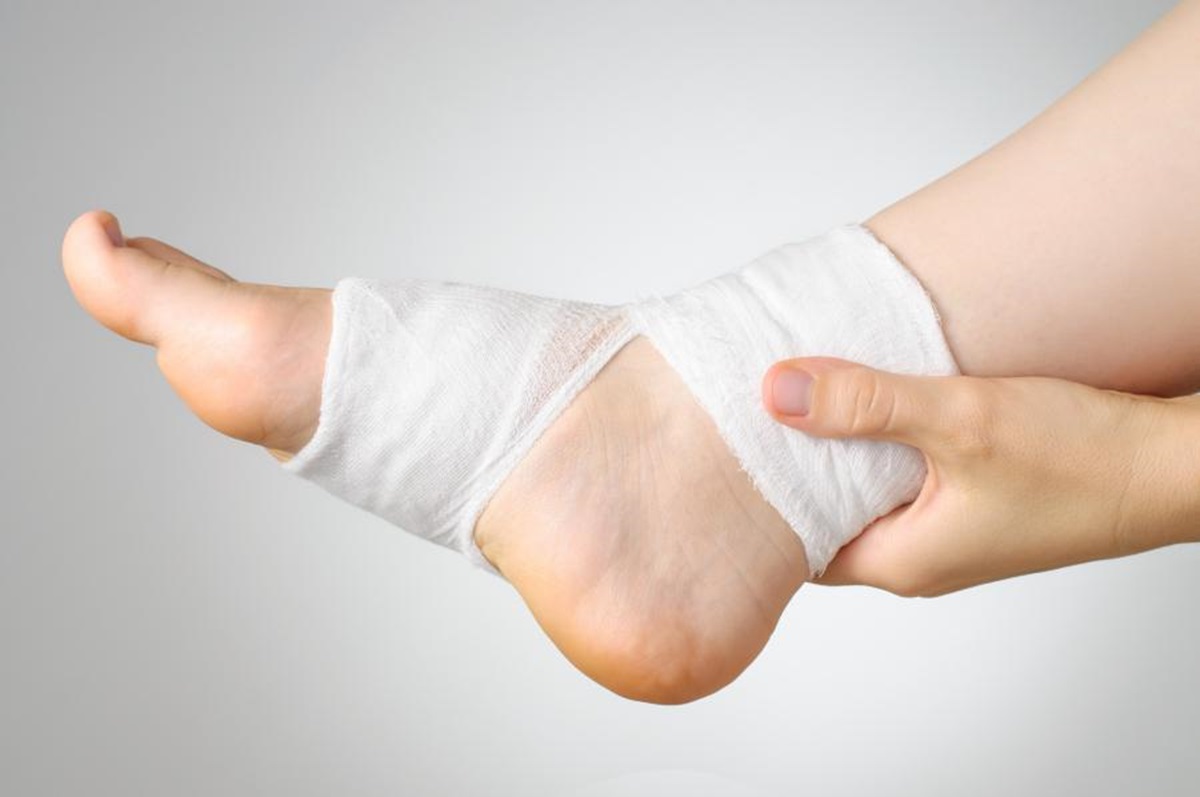 Sprained Ankle vs Broken Ankle What You Must Know