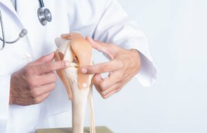 Doctor explaining permanent restrictions after knee replacement using a knee joint model to show how the new joint moves.